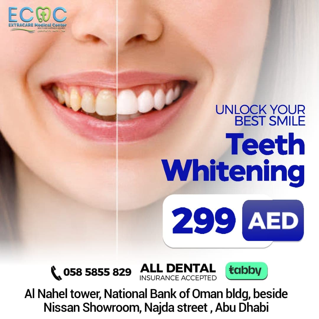 Teeth Whitening