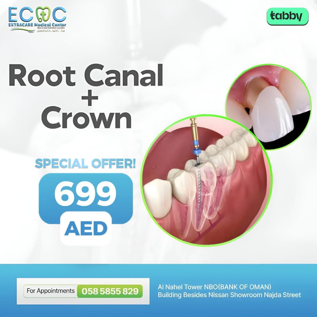 Root Canal Plus Crown Treatment