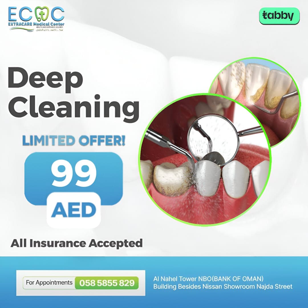 Deep Cleaning of Teeth